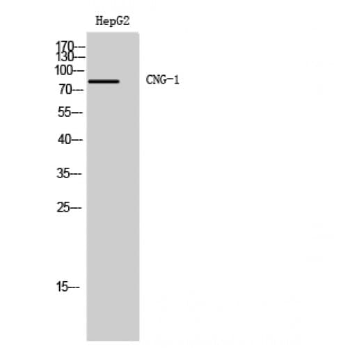 RP49 / CNG1 Antibody (370-450 aa, Internal)