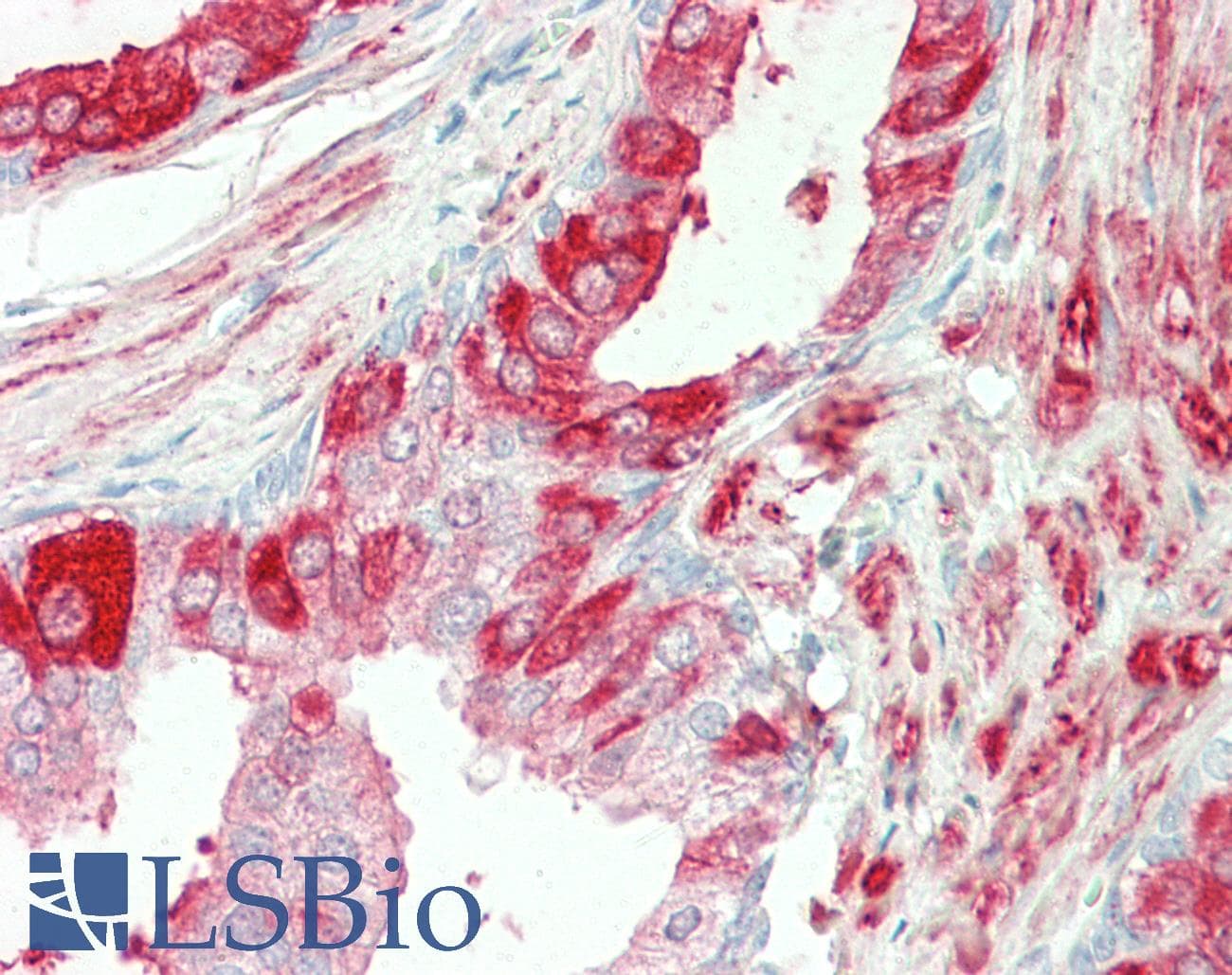 IHC-plus™ TGM4 / Transglutaminase 4 Antibody (aa49-63)