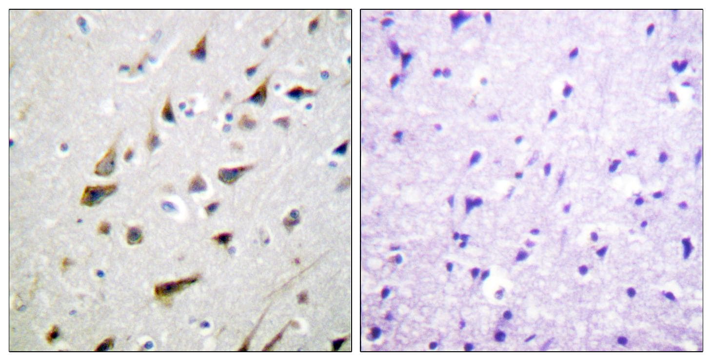 KCNIP3 / Dream / Calsenilin Antibody (p63)