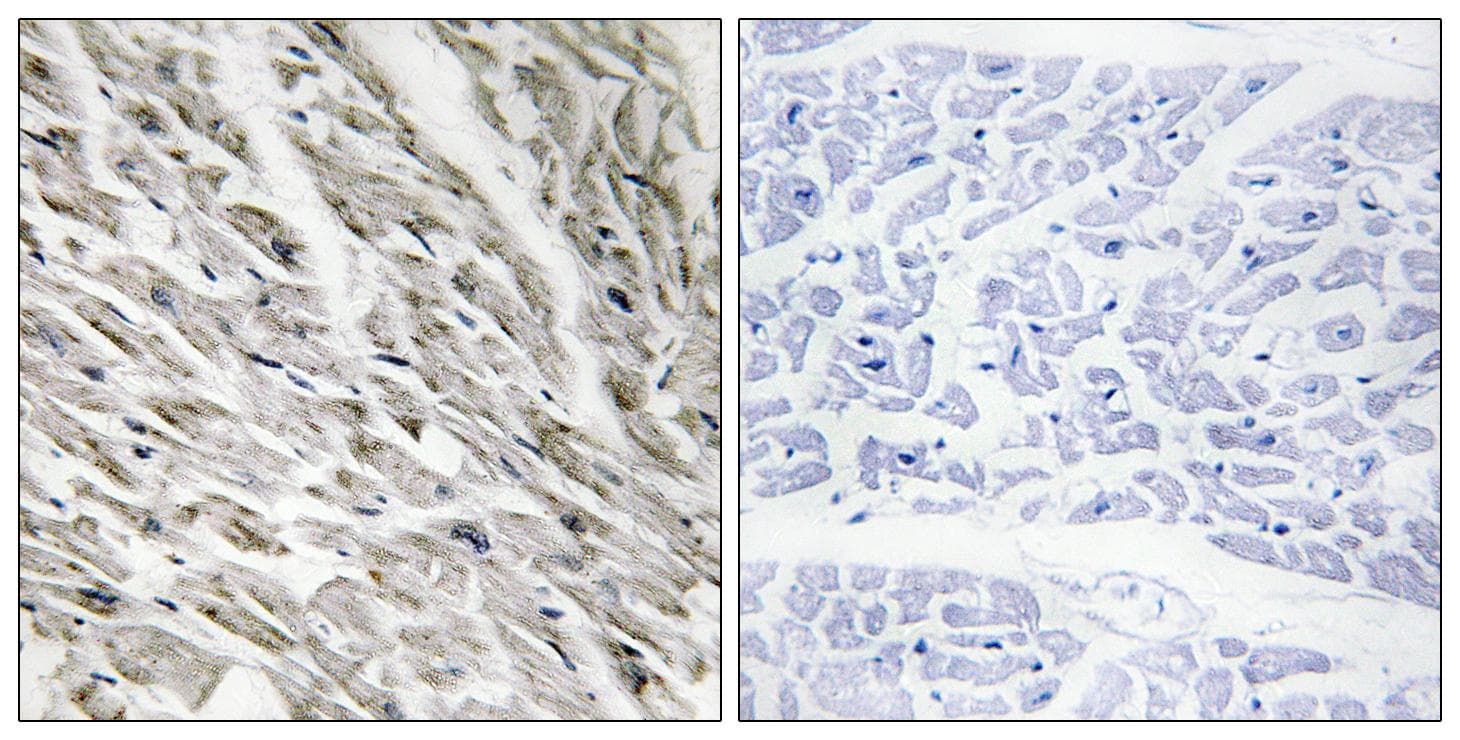 Polyclonal Rabbit anti-Human PPP1R14A / CPI-17 Antibody (phospho-Thr38, IHC, WB)