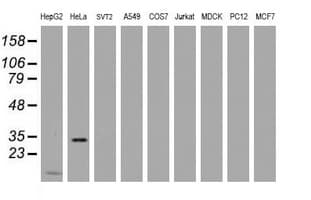 MMADHC / C2orf25 Antibody (aa39-296, clone OTI1G4)
