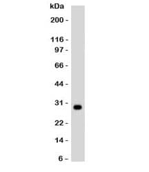 HLA-DRB1 Antibody (clone MHDRb2)