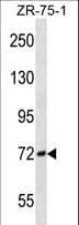 IHC-plus™ SCNN1B / ENaC Beta Antibody (aa306-332)