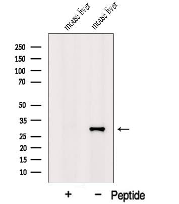 Polyclonal Rabbit anti-Human GSTZ1 Antibody (IF, WB)