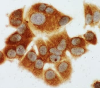 MAP2K1 / MKK1 / MEK1 Antibody (aa353-367)