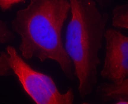 Polyclonal Rabbit anti-Human TH / Tyrosine Hydroxylase Antibody (phospho-Ser19, IF)