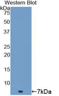 TMSB4X / Thymosin Beta-4 Antibody (aa1-44)