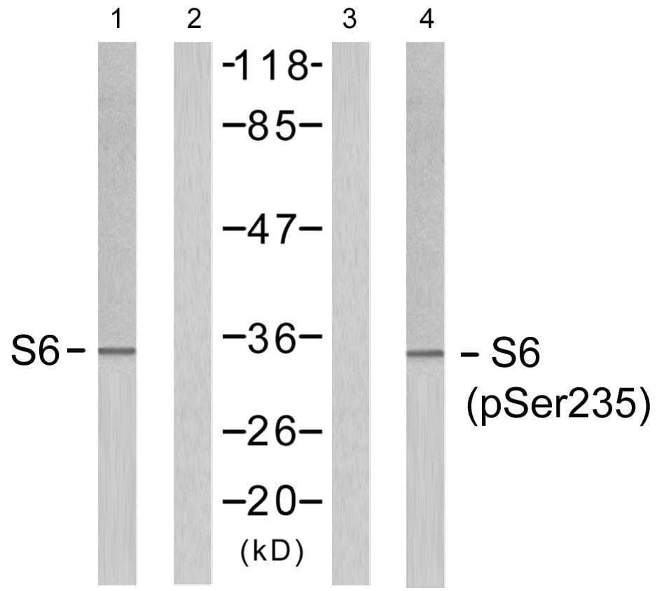 Polyclonal Rabbit anti-Human RPS6 / Ribosomal Protein S6 Antibody (phospho-Ser235, WB)