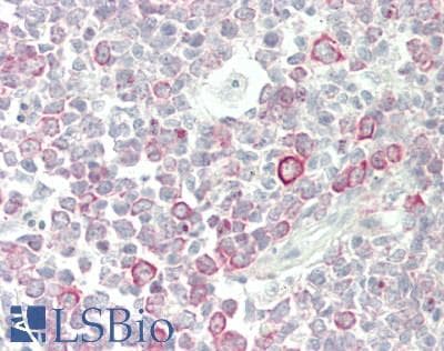 IHC-plus™ Polyclonal Rabbit anti-Human EEF1A1 Antibody (IHC, IF, WB)