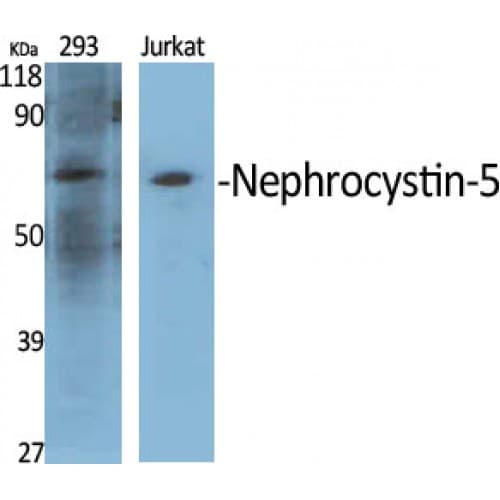 Polyclonal Rabbit anti-Human IQCB1 Antibody (400-480 aa, Internal, IHC, WB)