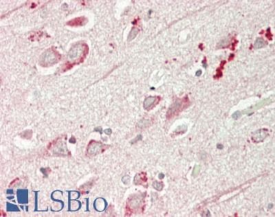 IHC-plus™ ADCY5 / Adenylate Cyclase 5 Antibody