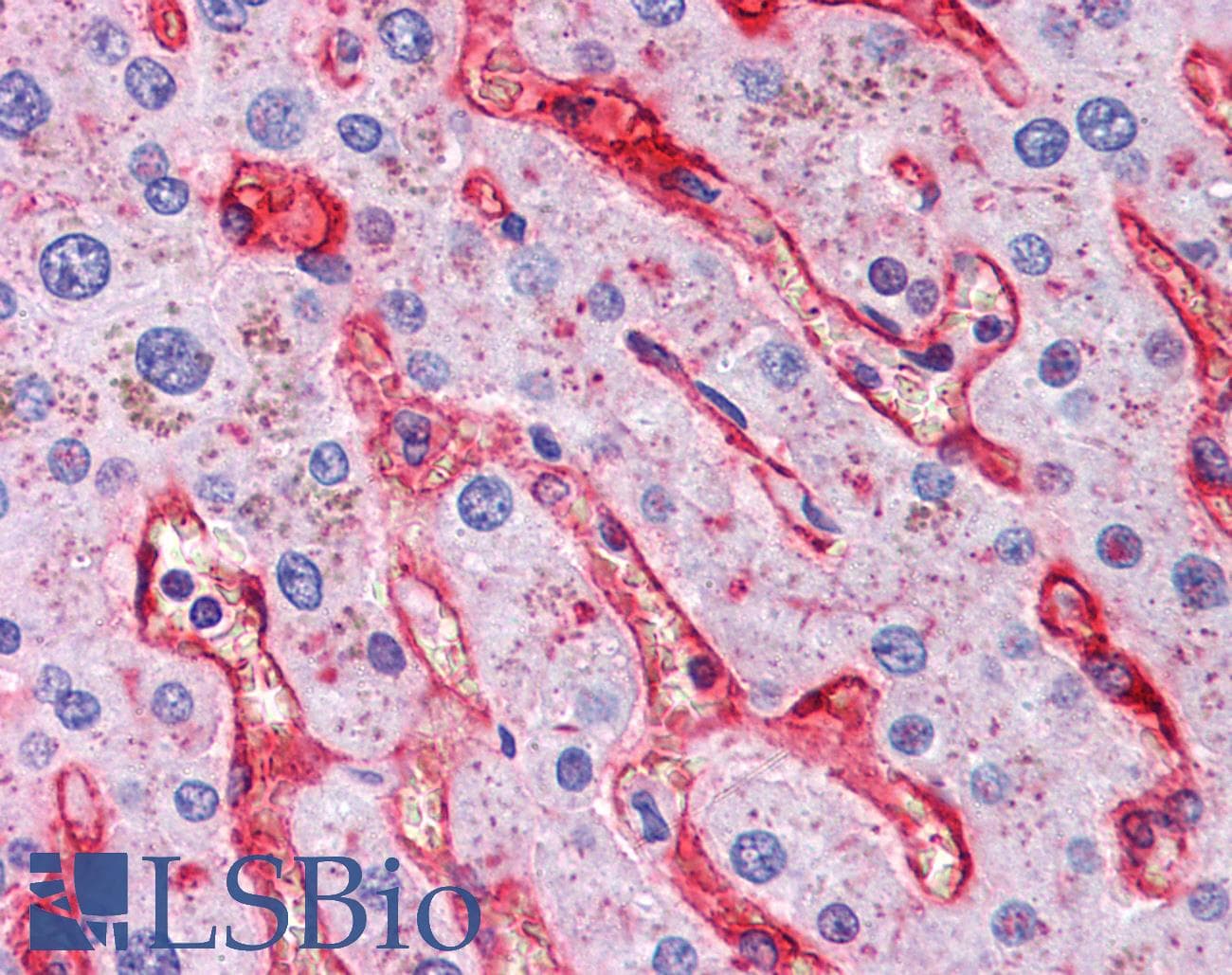 IHC-plus™ NT5E / eNT / CD73 Antibody (clone 1D7)