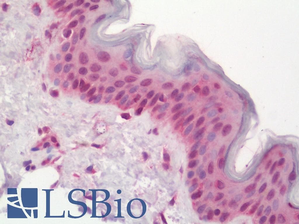 IHC-plus™ POLE4 / p12 Antibody (aa61-110)