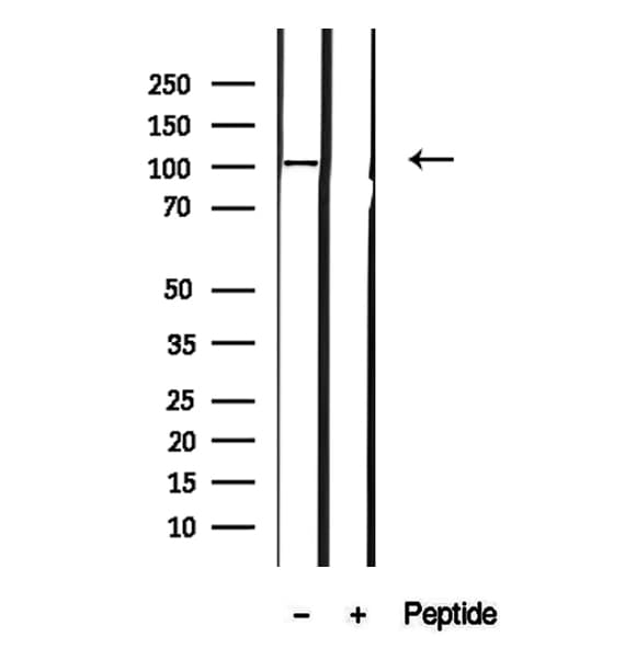 Polyclonal Rabbit anti-Human FTHFSDC1 / MTHFD1L Antibody (IHC, IF, WB)