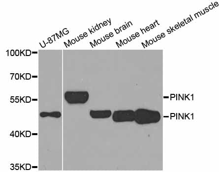 Polyclonal Rabbit anti-Human PINK1 Antibody (IHC, IF, WB)