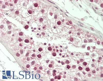IHC-plus™ Polyclonal Rabbit anti-Human GTF3A Antibody (aa1-50, IHC, WB)