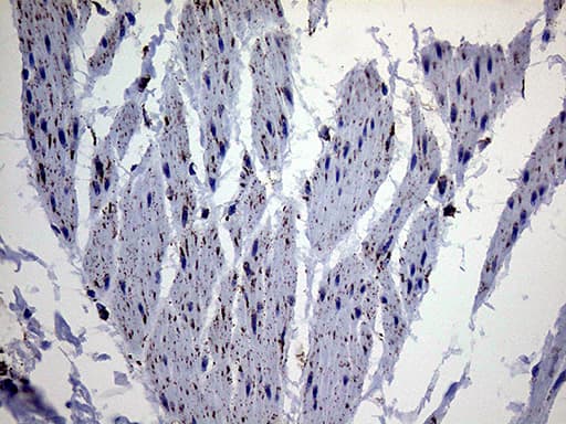 MLANA / Melan-A Antibody (aa48-118, clone OTI6G3)