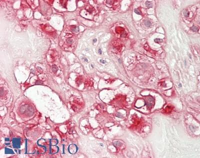 IHC-plus™ Polyclonal Rabbit anti-Human COL5A1 / Collagen V Alpha 1 Antibody (aa300-350, IHC, IF, WB)