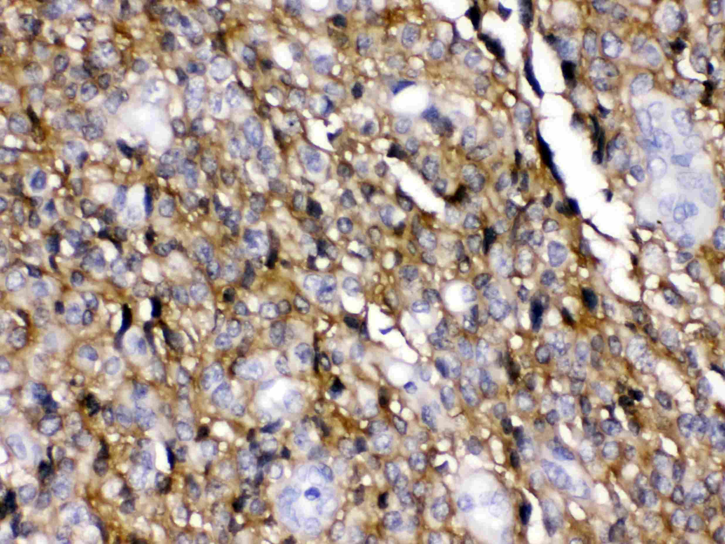SLC1A3 / EAAT1 Antibody