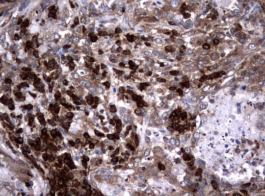 Monoclonal Mouse anti-Human NME1 / NM23 Antibody (clone UMAB94, Carrier-free, IHC, IF, WB)