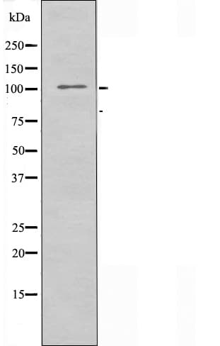 Polyclonal Rabbit anti-Human ARHGAP11A Antibody (IF, WB)