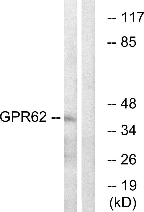 GPR62 Antibody