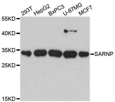 Polyclonal Rabbit anti-Human SARNP / Hcc-1 / CIP29 Antibody (WB)