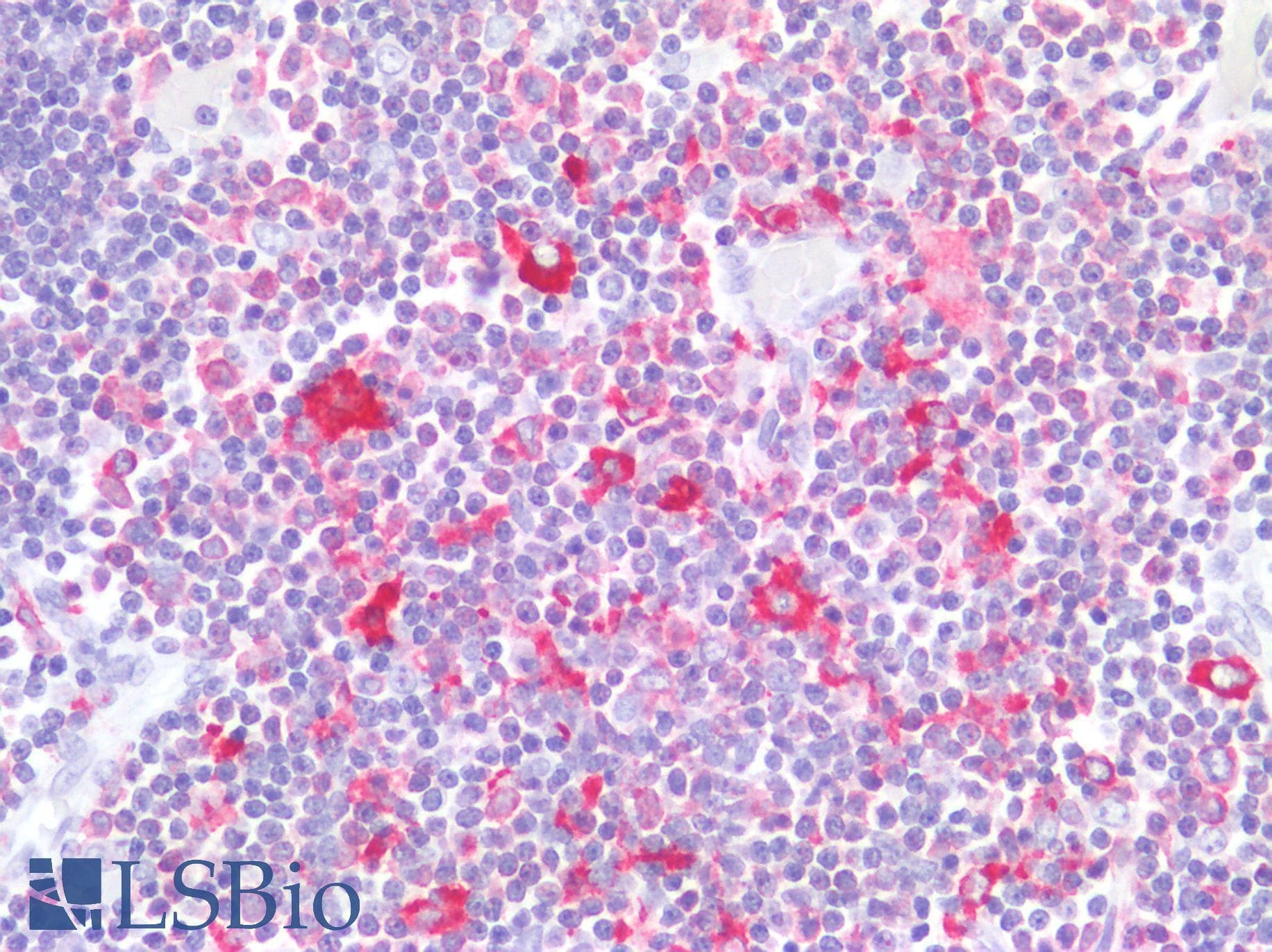 PathPlus™ LSP1 Antibody (aa37-48)