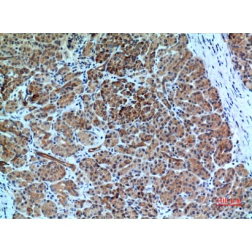 Polyclonal Rabbit anti-Human CXCR6 Antibody (1-50 aa, N-terminal, IHC, WB)