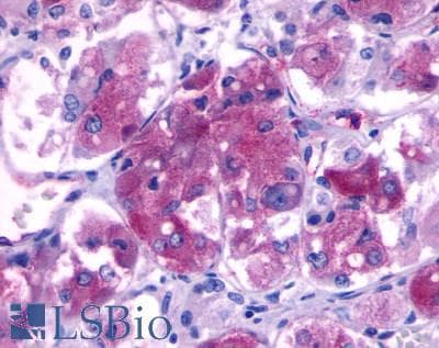PathPlus™ Polyclonal Rabbit anti-Human B1R / BDKRB1 Antibody (C-Terminus, IHC)