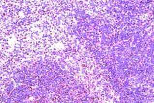 CCR8 / CD198 Antibody (aa7-33)