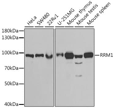 R1 / RRM1 Antibody
