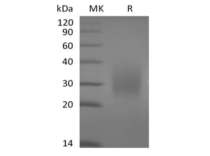 Human CD79A / CD79 Alpha Protein (Recombinant 6His, C-terminus)
