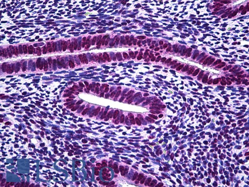 IHC-plus™ STAT1 Antibody (aa694-743)