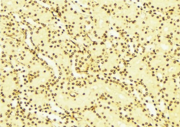 Polyclonal Rabbit anti-Human NOTCH2 Antibody (Cleaved Asp1733, IHC, IF, WB)