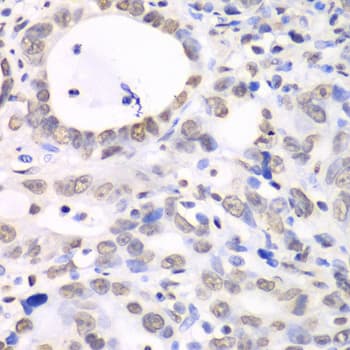 Polyclonal Rabbit anti-Human NONO / P54NRB Antibody (IHC, IF, WB)