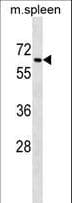 Polyclonal Rabbit anti-Mouse TGFBR2 Antibody (aa548-575, WB)