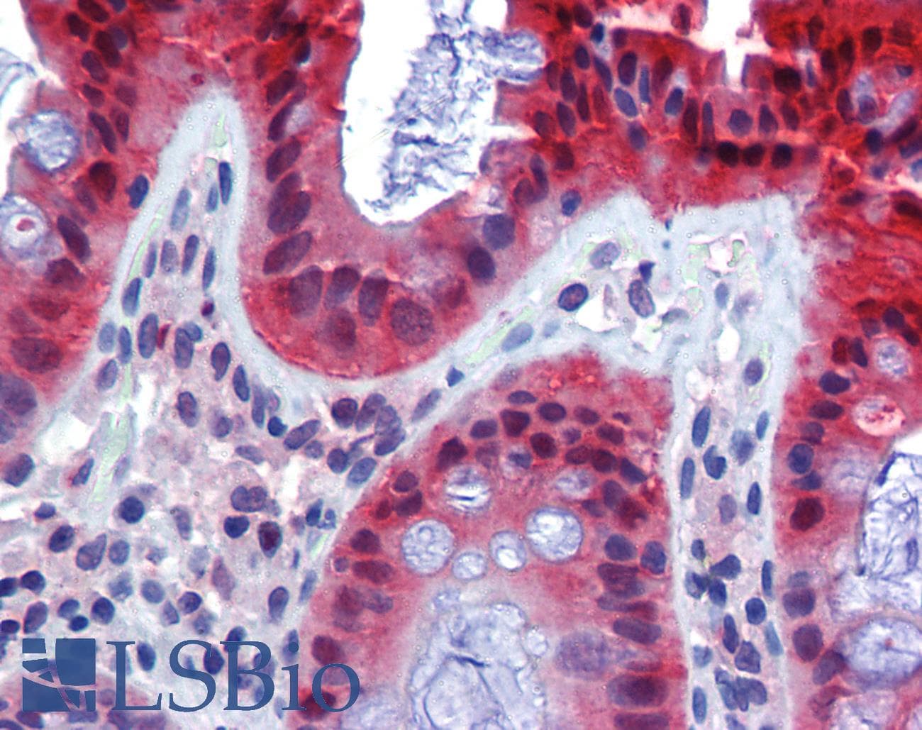 IHC-plus™ Monoclonal Mouse anti-Human CASP7 / Caspase 7 Antibody (clone 7-1-11, IHC, WB)