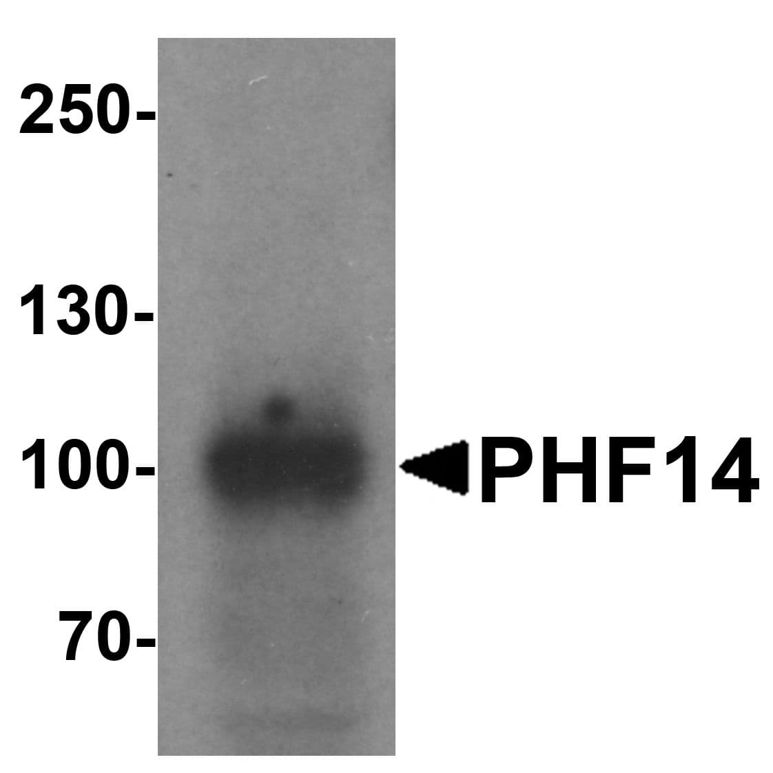 IHC-plus™ Polyclonal Rabbit anti-Human PHF14 Antibody (IHC, IF, WB)