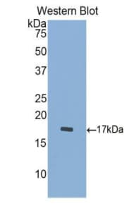 CTSD / Cathepsin D Antibody (aa23-161)