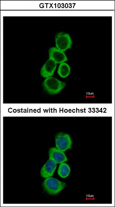 BHMT Antibody (aa1-243)