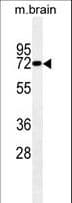 Monoclonal Mouse anti-Mouse LIMK1 / LIMK Antibody (aa479-508, WB)