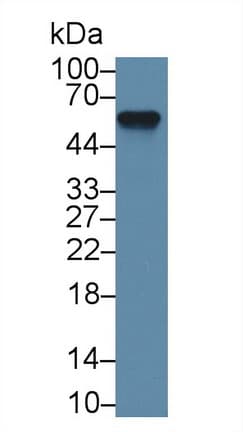 AHSG / Fetuin A Antibody (aa19-250)