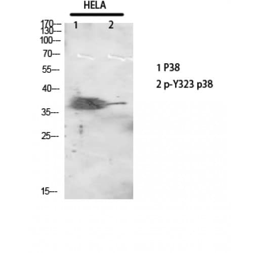 MAPK14 / p38 Antibody (260-340 aa)