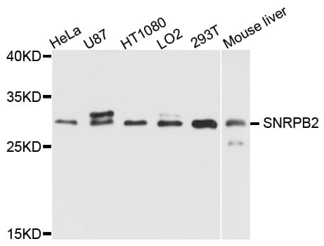 Polyclonal Rabbit anti-Human SNRPB2 Antibody (WB)