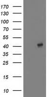 Monoclonal Mouse anti-Human MAPRE2 / EB2 Antibody (clone OTI7C10, IF, WB)