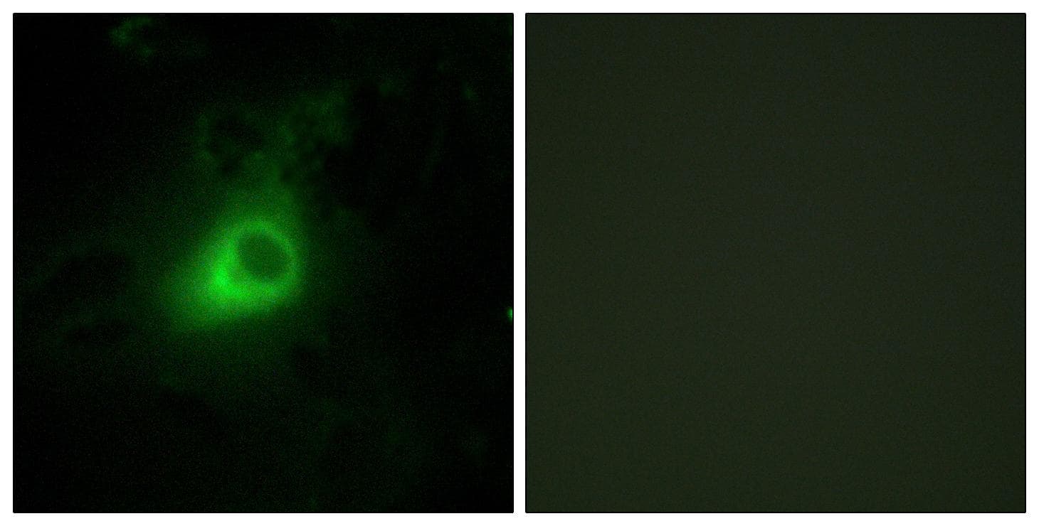 Polyclonal Rabbit anti-Human GRK6 Antibody (IF, WB)