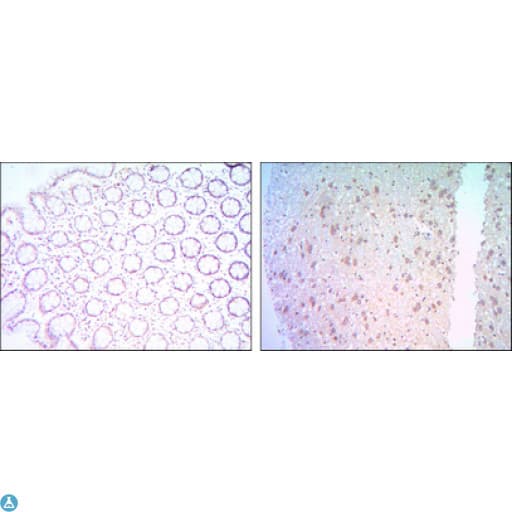 BCL2 / Bcl-2 Antibody