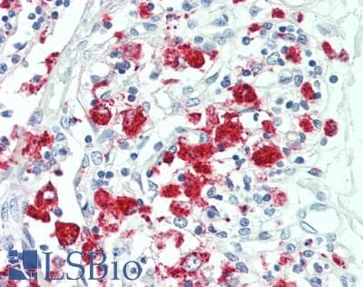 IHC-plus™ NLRP12 Antibody (aa183-212)