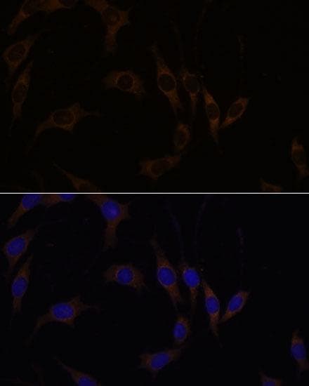 RGS4 Antibody